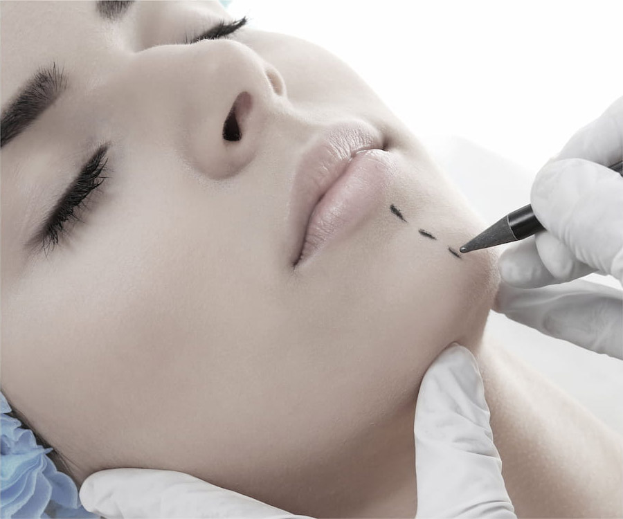 doctor marking woman's chin with pencil