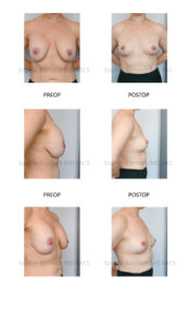 patient pictures