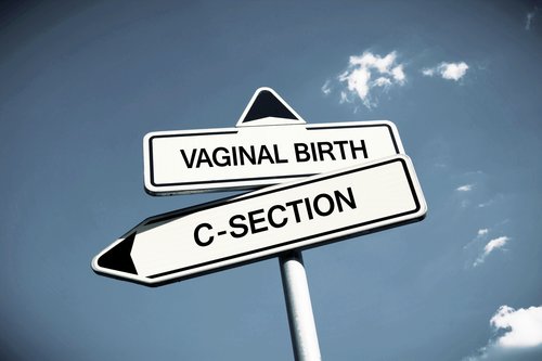 road sign reading c-section and vaginal birth
