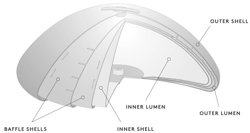 ideal implant diagram