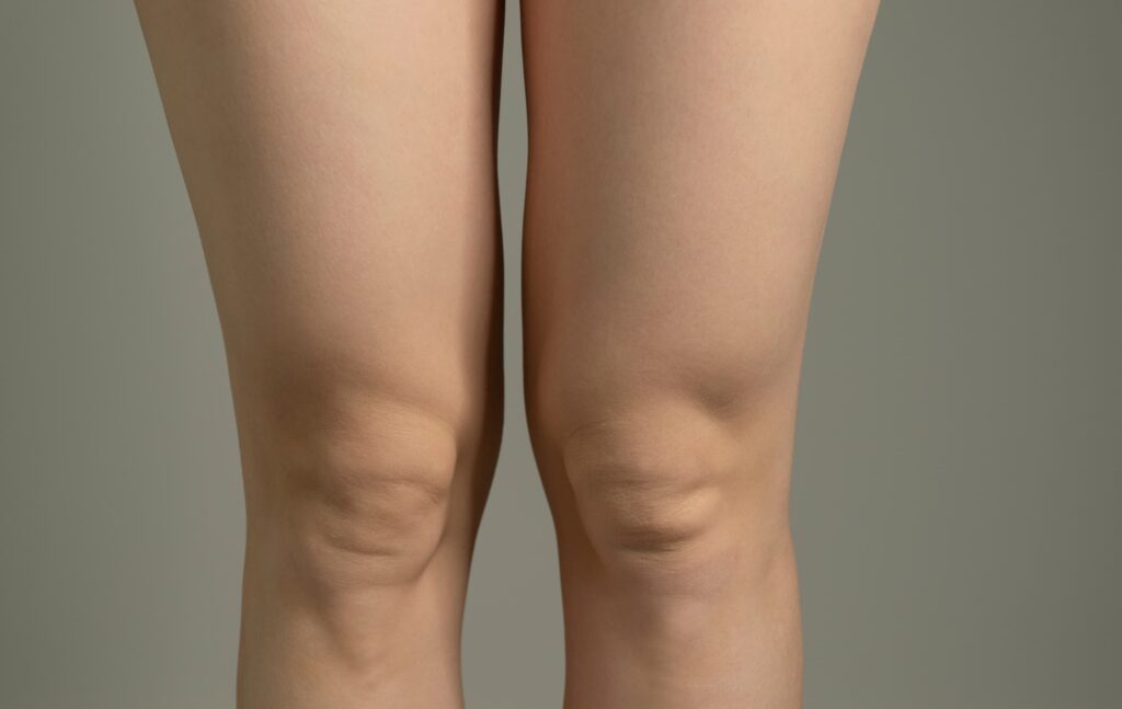 A woman's legs.