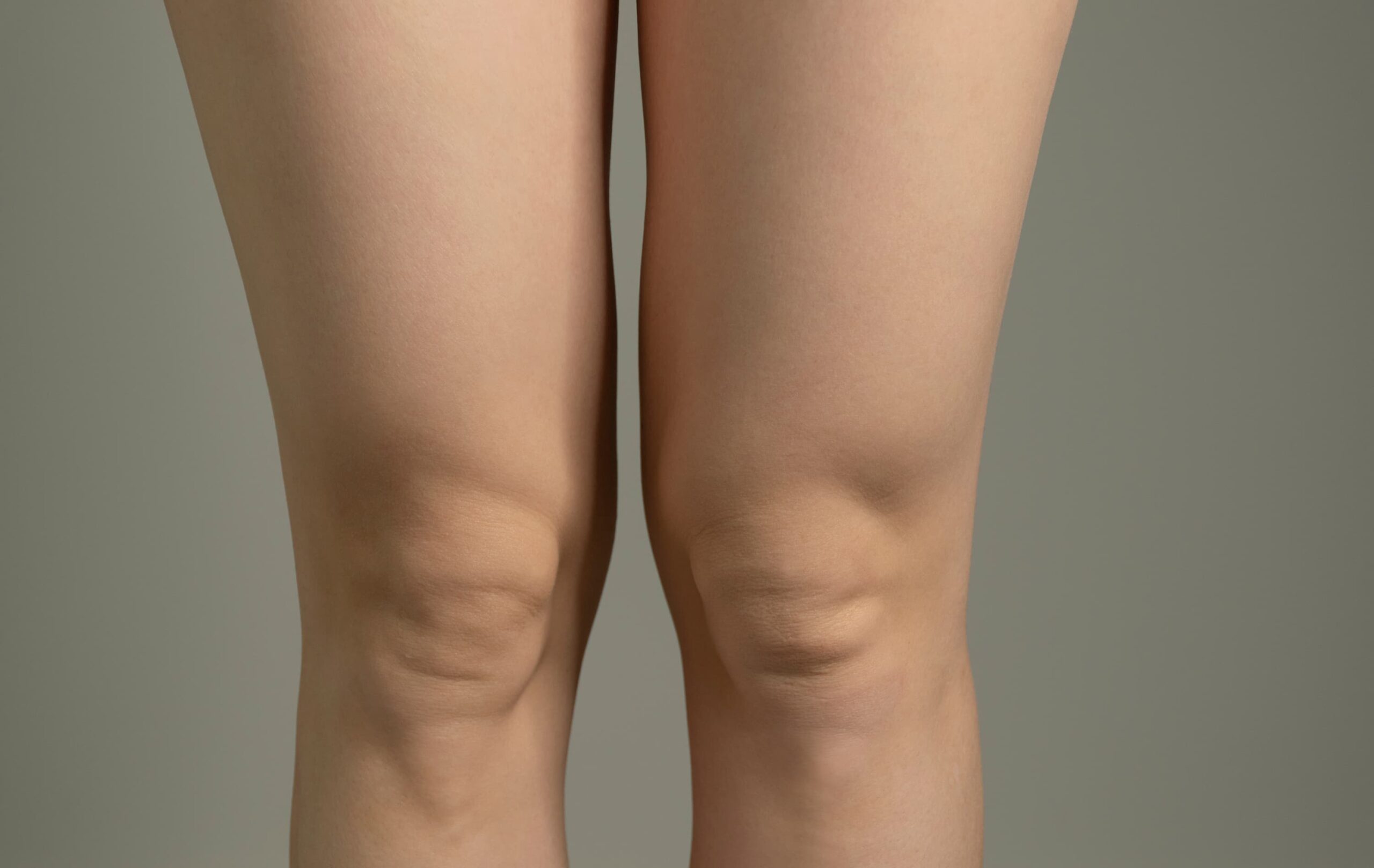 A woman's legs