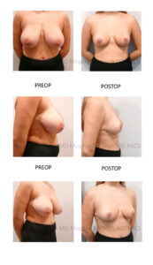 patient pictures