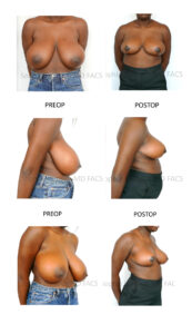 patient pictures