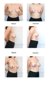 patient pictures