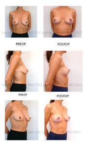 patient pictures