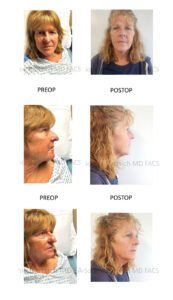patient pictures