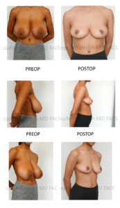 patient pictures