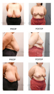 patient pictures