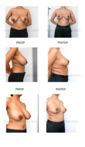 patient pictures