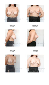 patient pictures